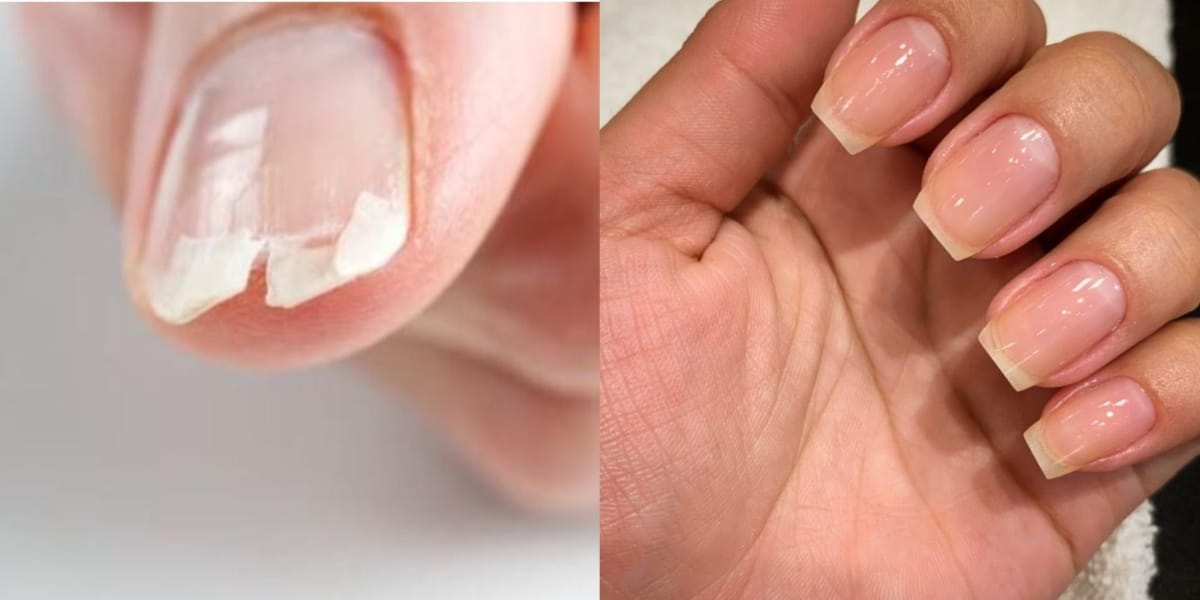 unhas antes e depois http://www.otvfoco.com.br/wp-content/uploads/2015/05/Daniela-Mercury.jpg