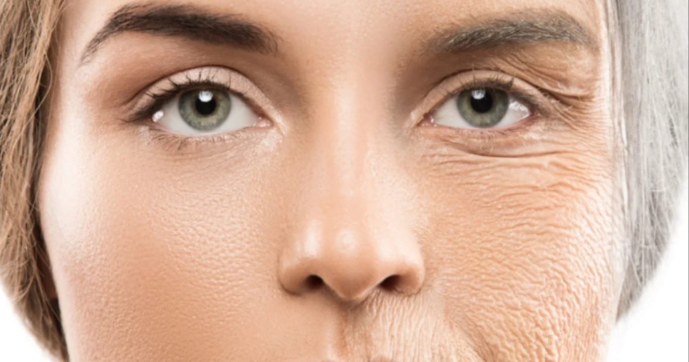 Lifting facial caseiro faz colágeno disparar na pele em 5 minutos (Foto: Reprodução Internet)