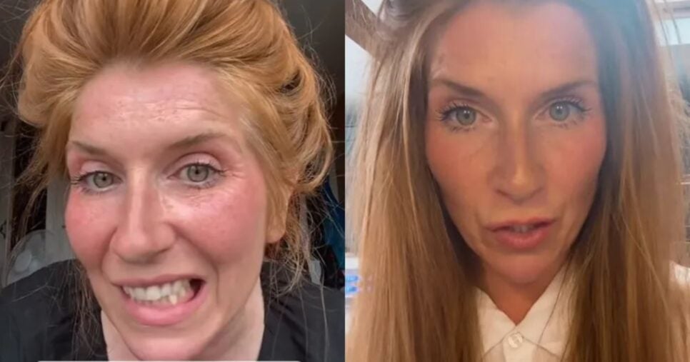 Antes e depois de Kate