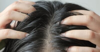 Cabelo oleoso (Foto: Canva)