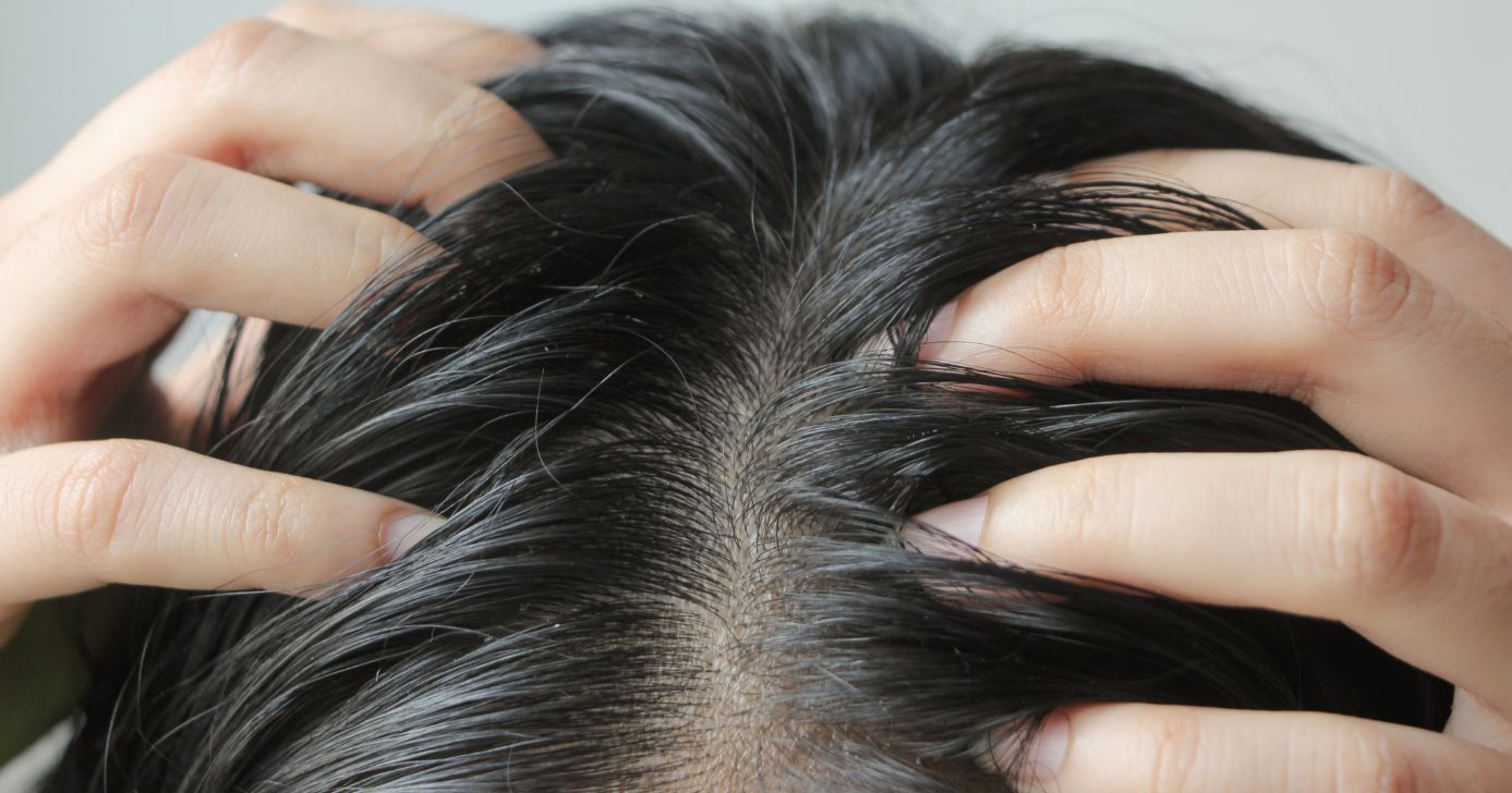 Cabelo oleoso (Foto: Canva)