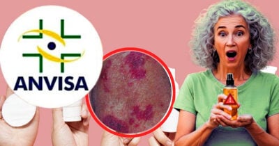 ANVISA proíbe óleo corporal, amplamente usado por 60+ após risco de vermelhidão e + (Foto Reprodução/Montagem/Tv Foco/Canva)