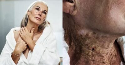 Tônico facial elimina rugas e manchas durante a noite (Foto Reprodução/Montagem/Internet)