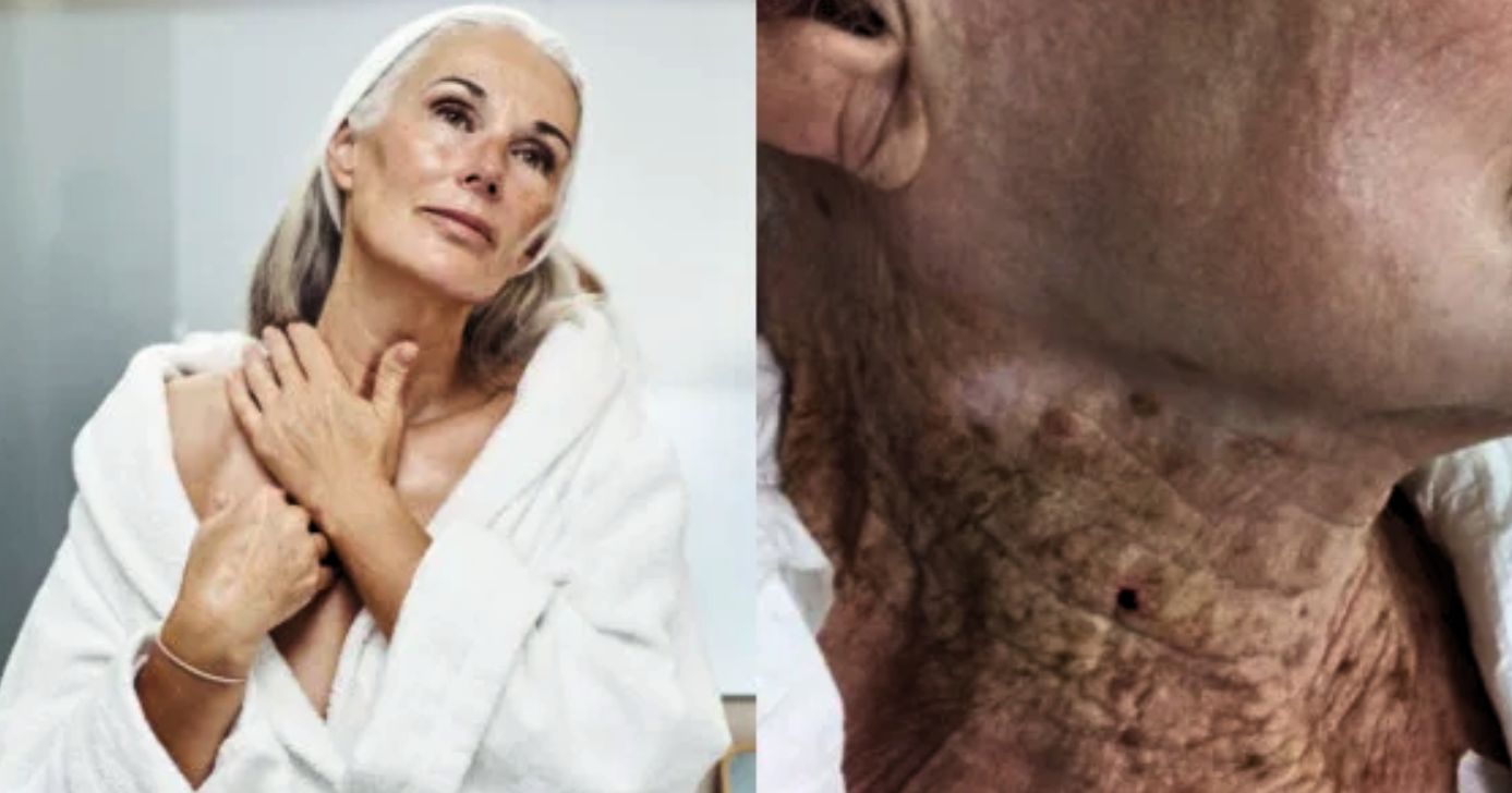 Tônico facial elimina rugas e manchas durante a noite (Foto Reprodução/Montagem/Internet)