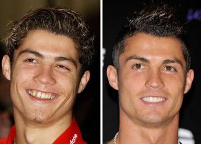 O bonitão Cristiano Araújo, antes e depois da fama (Foto montagem)