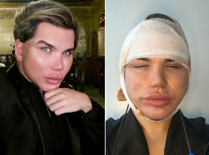 Ken, e Rodrigo Alves Foto: Reprodução