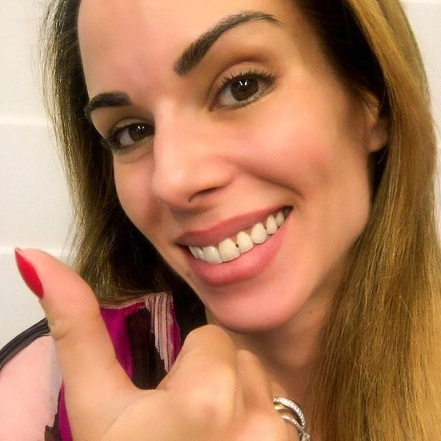 Ana Furtado imita Katy Perry e posta foto com sujeira no dente Foto: Reprodução