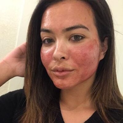 Geisy Arruda adere a procedimento diferente. (Foto: Reprodução/Instagram)