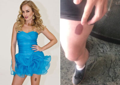 Imagem PreCarregada