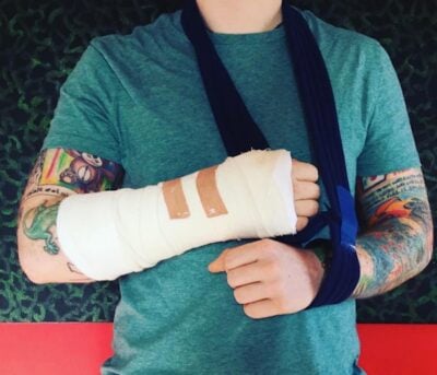 O cantor Ed Sheeran sofre acidente. (Foto: Reprodução/Instagram)