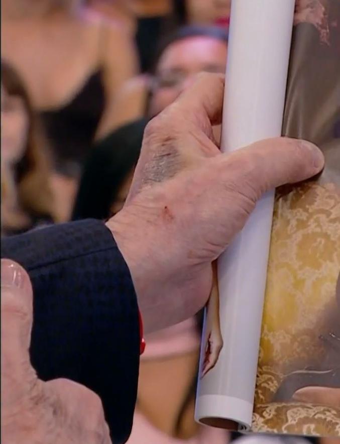 Silvio Santos aparece com machucado na mão (Foto: Reprodução/SBT)