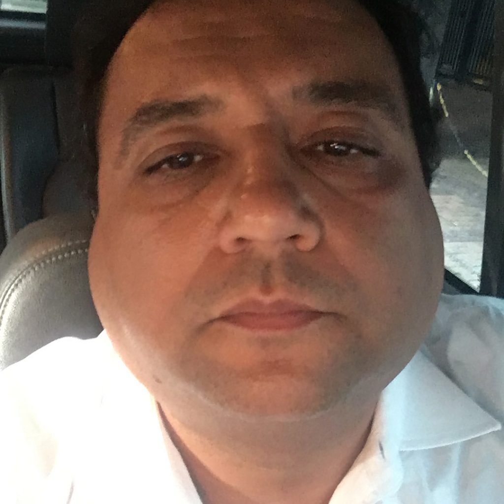 Geraldo Luís com caxumba