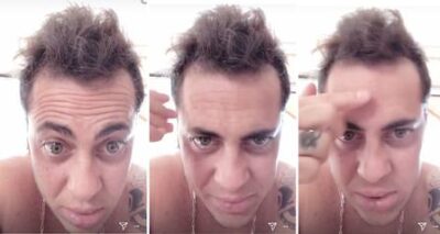 Thammy Miranda reclama de queda do cabelo. (Foto: Reprodução/Instagram)