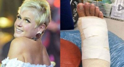 Xuxa quebra o pé (Foto: Reprodução/R7)