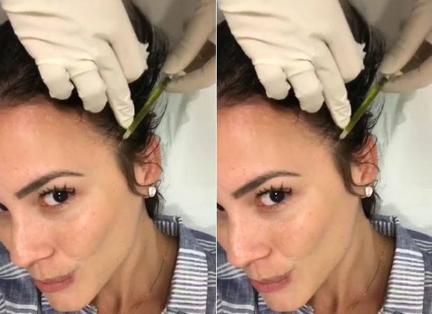 Juliana Knust faz tratamento para queda de cabelo assim como Ana Furtado (Foto reprodução)