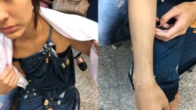Em boletim de ocorrência, Leticia Almeida diz que foi agredida pela ex-sogra e tirou fotos na delegacia (Foto: Reprodução)