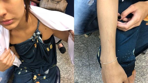 Em boletim de ocorrência, Leticia Almeida diz que foi agredida pela ex-sogra e tirou fotos na delegacia (Foto: Reprodução)