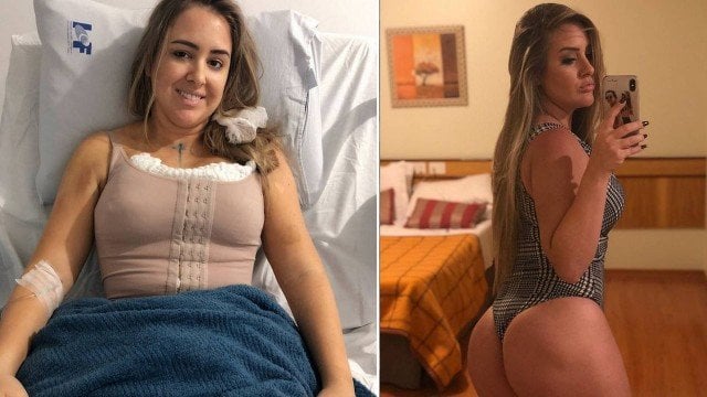 Patrícia, do BBB18, fez lipoescutura, colocou silicone nos seios e injetou gordura no bumbum (Foto: Reprodução/Instagram)
