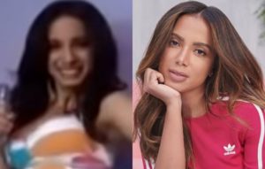 Anitta antes e depois da fama (Foto: Reprodução)