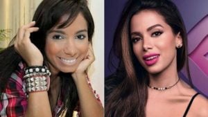 Anitta fala das plásticas (Foto: Divulgação/Boticário)