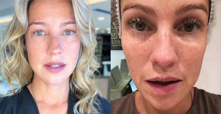 Antes e depois de Luana (Foto: Reprodução)