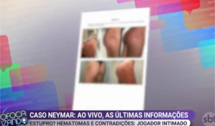 "Suposta