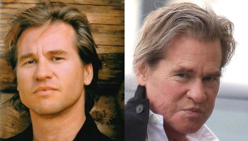 O antes e o depois do ator Val kilmer (Foto: Reprodução) O antes e o depois do ator Val kilmer (Foto: Reprodução)