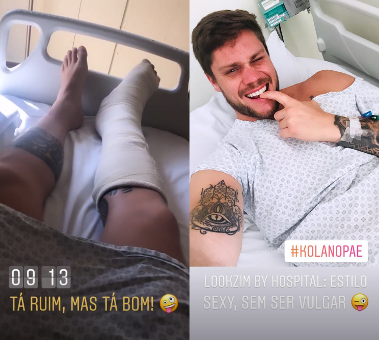 Ex-participante do BBB Breno Simões fraturou o tornozelo (Foto: Reprodução/ Instagram)