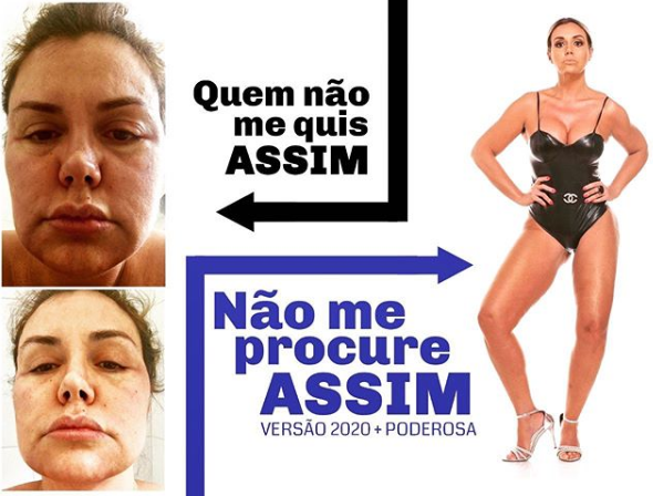Renata Banhara inchada com infecção de dente (Foto: Reprodução/ Instagram)
