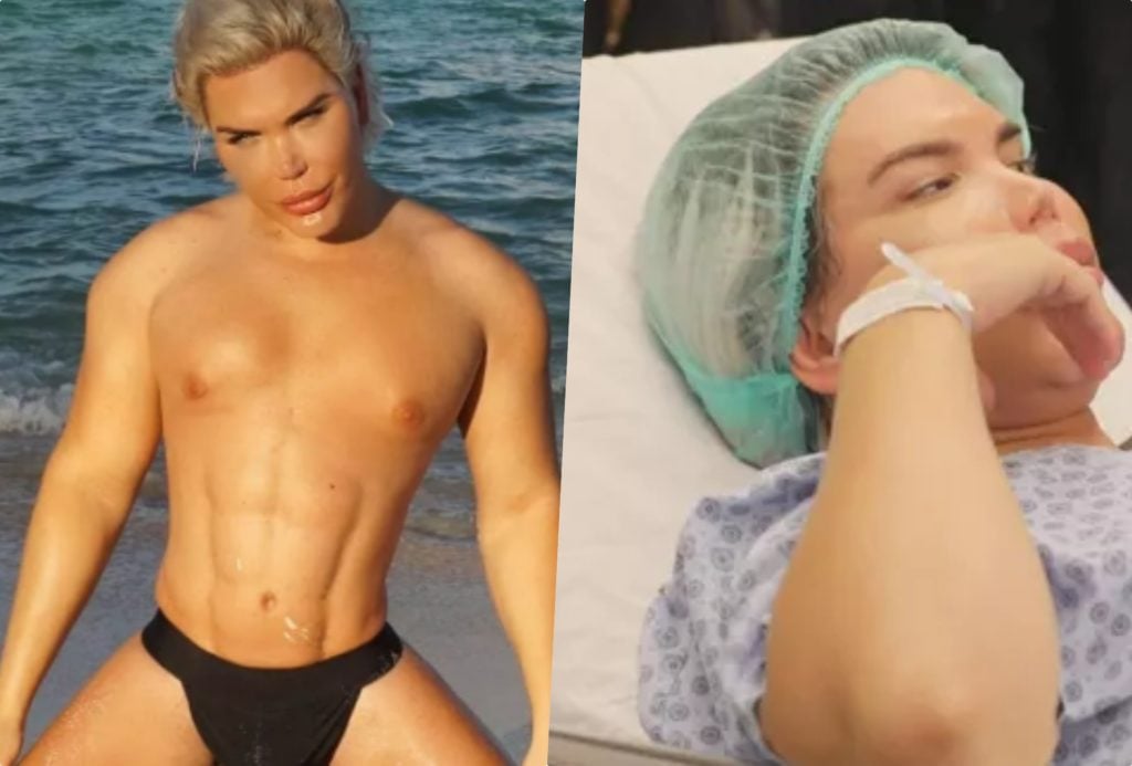 Rodrigo Alves, o Ken Humano, faz nova cirurgia (Foto: Reprodução)
