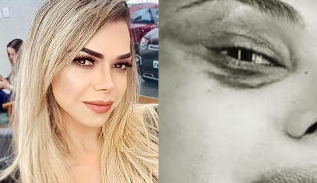 Léo Áquilla apareceu com rosto machucado e preocupou os seus fãs (Foto: Montagem/TV Foco)