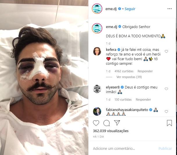 Dj Eme depois que sofreu o acidente. fica com o rosto desfigurado (Imagem: 