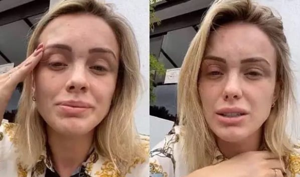 Assim como Glamour Garcia, Monick Camargo também foi vítima de agressão do companheiro