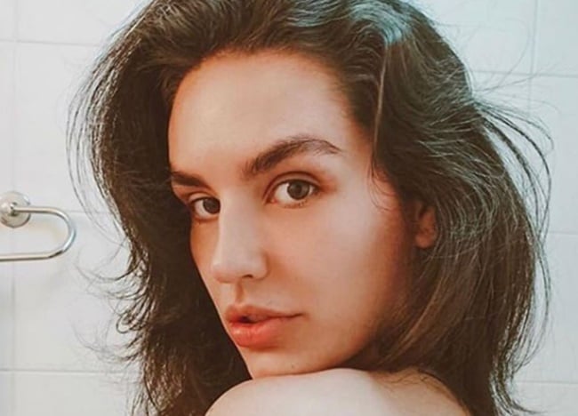 Youtuber Kéfera sofreu acidente durante festa e acabou cortando a bunda (Foto: Reprodução)