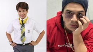 Imagem PreCarregada