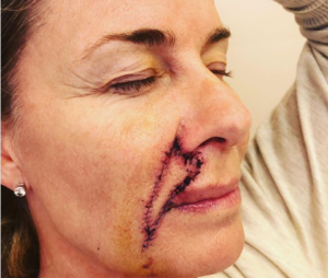 Diagnosticada com câncer, apresentadora faz desabafo e revela gravidade: “tarde demais”