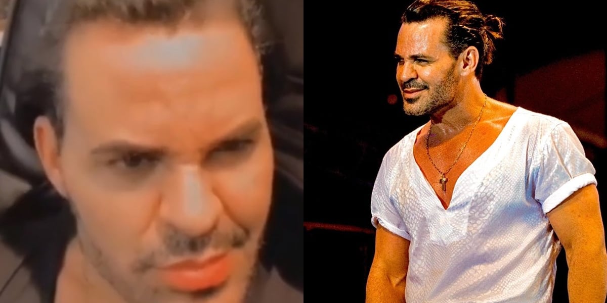 Eduardo Costa assumiu sexualidade após procedimento (Foto montagem: TV Foco)