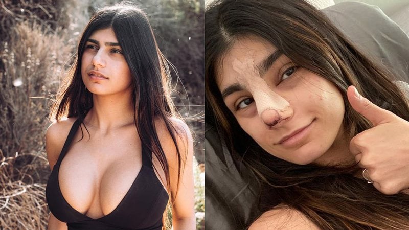 A ex-atriz pornô Mia Khalifa realizou uma rinoplastia à poucos dias (Foto: Reprodução)