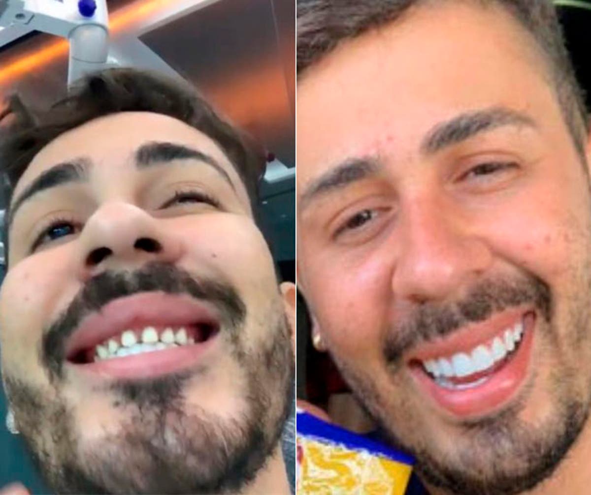 Carlinhos Maia sem e com lente nos dentes 