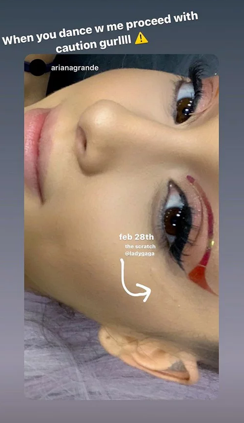 Stories feito por Ariana Grande mostrando o arranhão (Foto: Reprodução)
