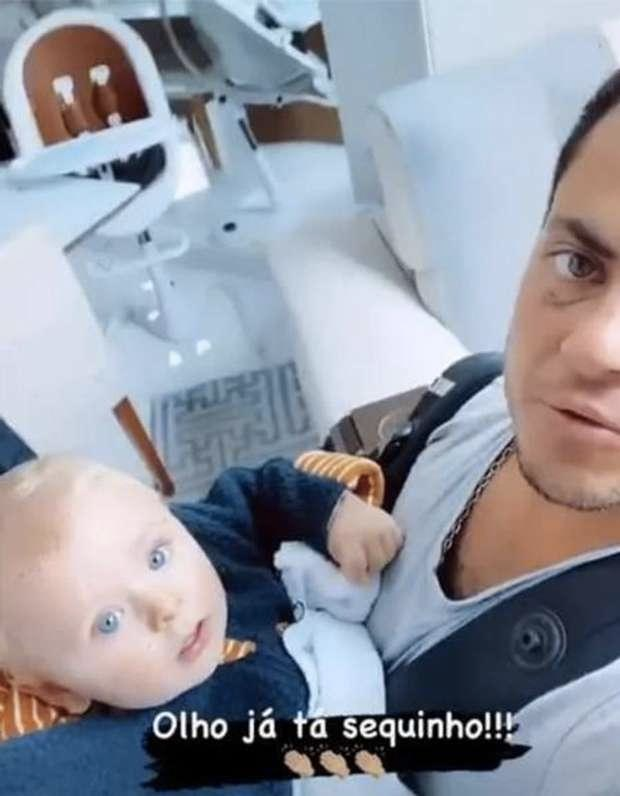 Thammy Miranda apareceu com o olho roxo (Foto: reprodução)