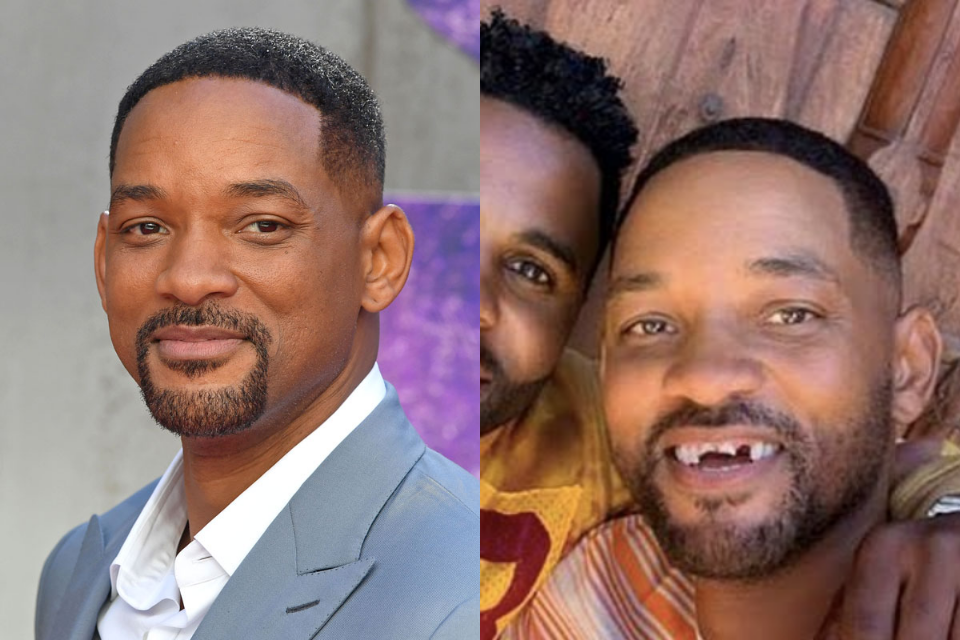 Will Smith quebra os dentes durante partida de golfe com amigo e preocupa (Foto: Reprodução)