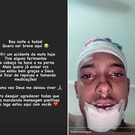 MC Brinquedo se manifestou nas redes sociais após acidente (Foto: Montagem)