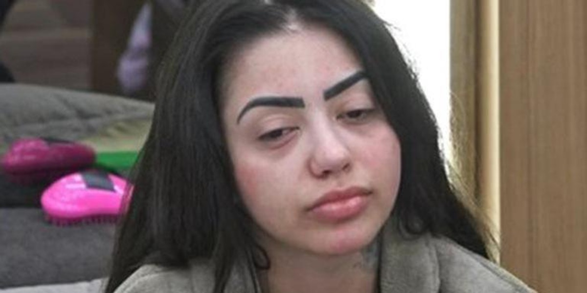 MC Mirella com rosto inchado em A Fazenda 12 (Foto: Reprodução)