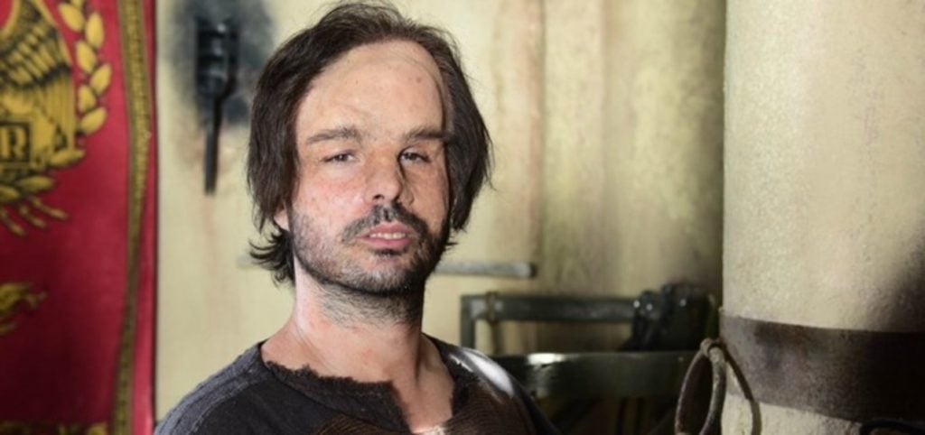 Sergio Abreu é Hidrópico na novela Jesus