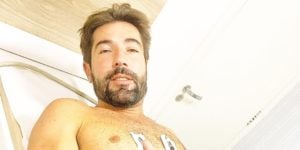 Sandro Pedroso ficou entre a vida e a morte (Foto: reprodução)