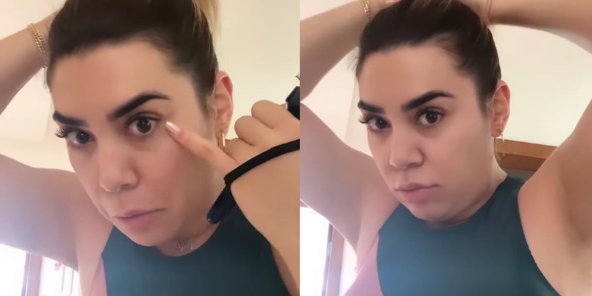Naiara Azevedo apareceu nos stories com o rosto inchado (Foto: Reprodução)
