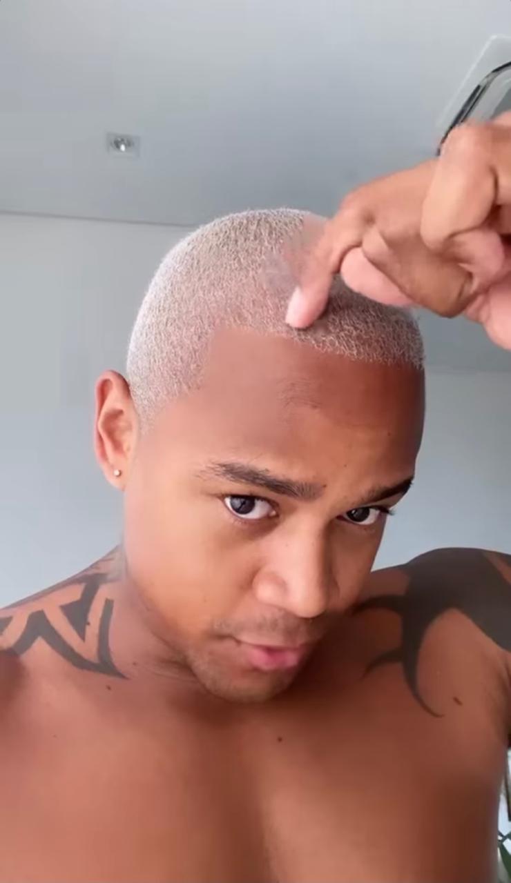 Artista aparece sem camisa para celebrar transplante capilar (Reprodução: Instagram)