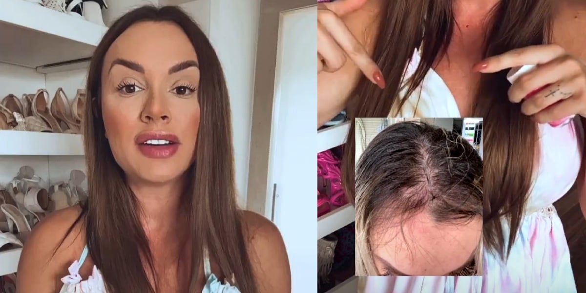 Apresentadora Juju Salimeni mostra foto do cabelo quando descobriu depressão (Foto: Reprodução/Instagram)