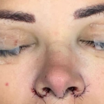 Ex-BBB Ariadna é submetida a cirurgia e fala sobre dor